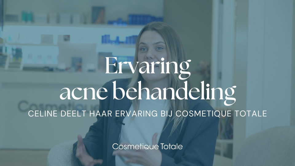 Microneedling Voor Acne Celine Deelt Haar Ervaring (1)