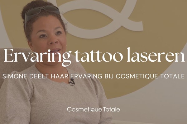 Tattoo Laseren Ervaring Simone
