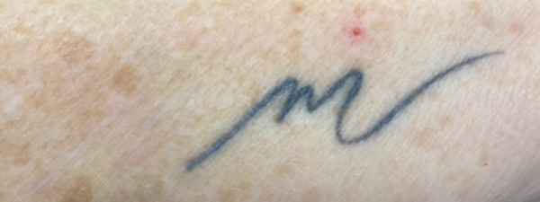 Tattoo 6X 2