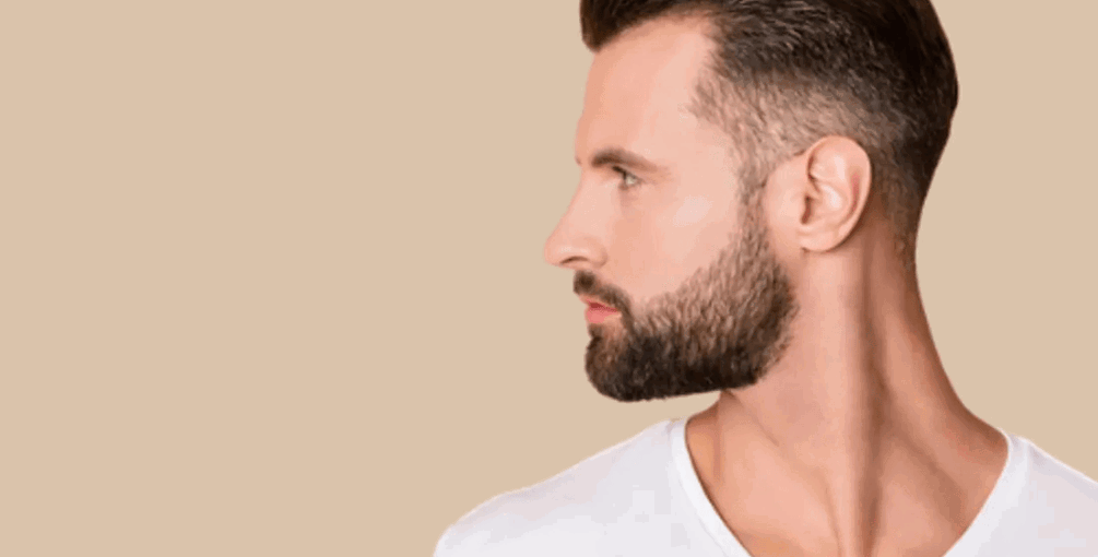 Épilation Définitive Au Laser De La Barbe