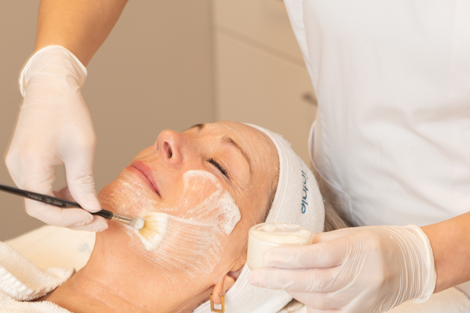 Microneedling Behandlung