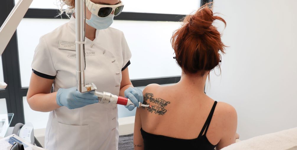 Tattoo Laseren Informatie