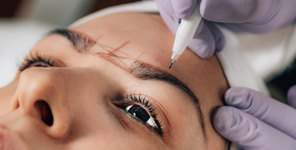 Alles Wat Je Moet Weten Over Microblading En Het Verwijderen Ervan