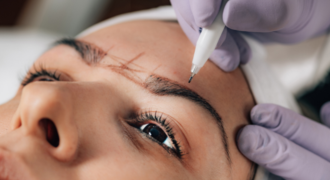 Alles Wat Je Moet Weten Over Microblading En Het Verwijderen Ervan