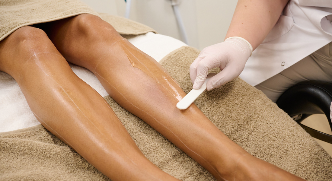 Beinhaarentfernung Mit Lasertherapie