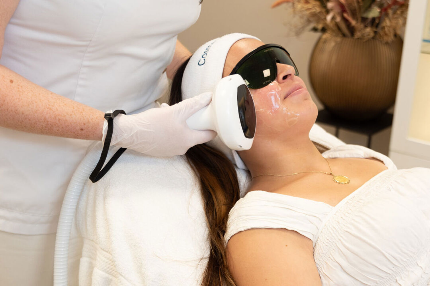 Laserbehandeling Bij Melasma