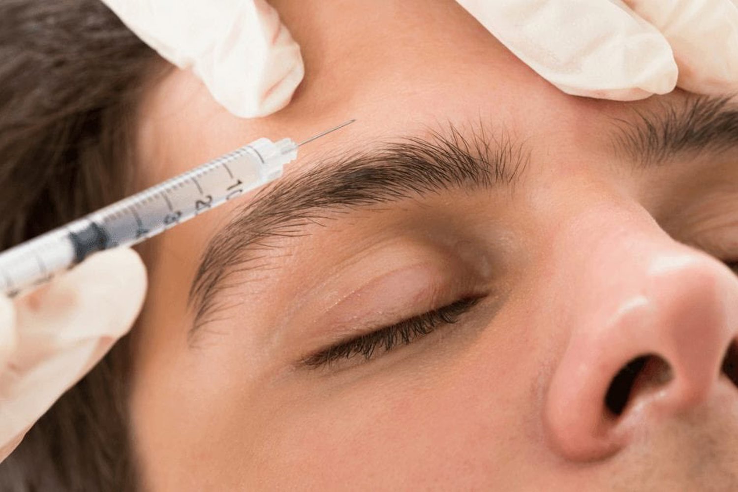 Botox Voor Hoofdpijn En Migraine