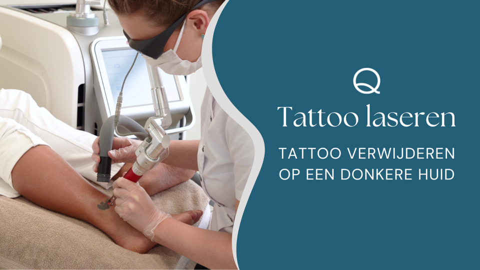 Tattoo Verwijderen Op Een Donkere Huid