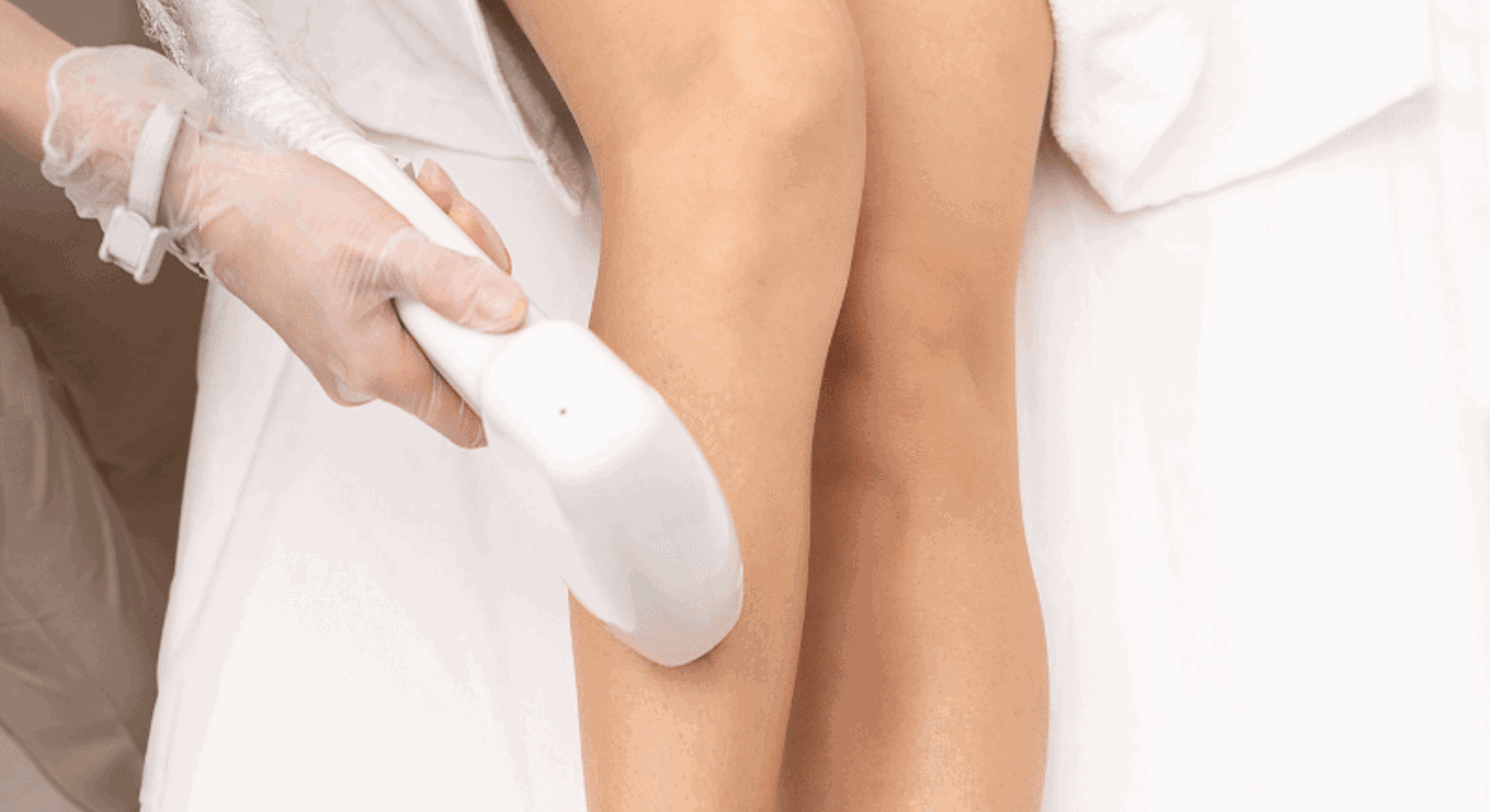 epilation laser sopk