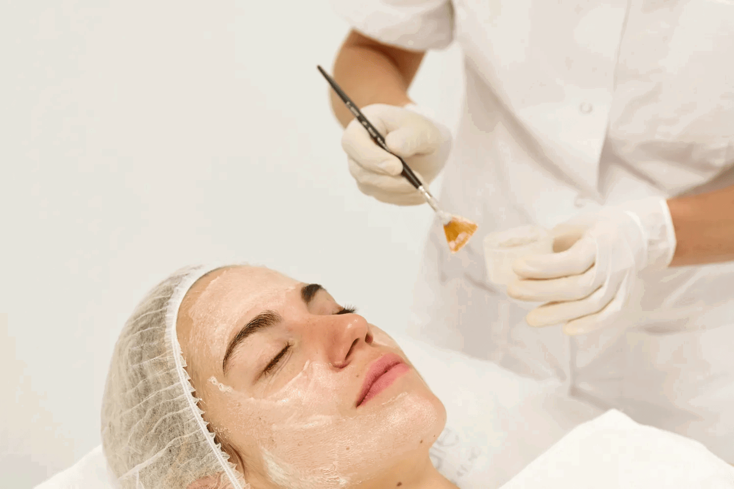 Peeling Médical En Été