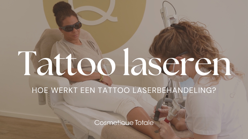 Tatoeage Verwijderen Met De Picolaser