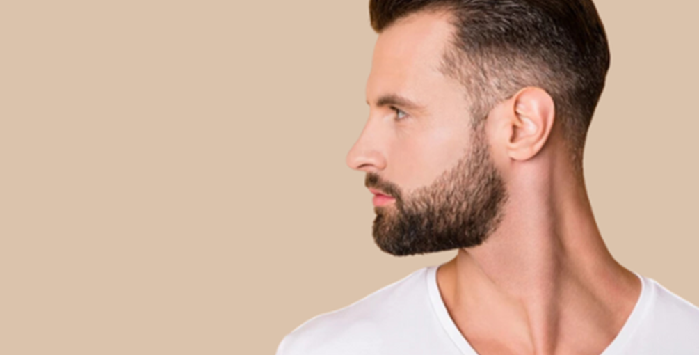 Dauerhafte Haarentfernung Im Bartbereich