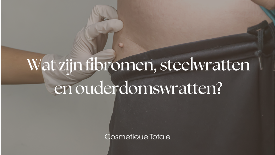 Wat Zijn Fibromen, Steelwratten En Ouderdomswratten (1)