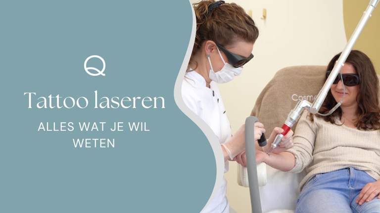 Alles Over Tattoo Laseren