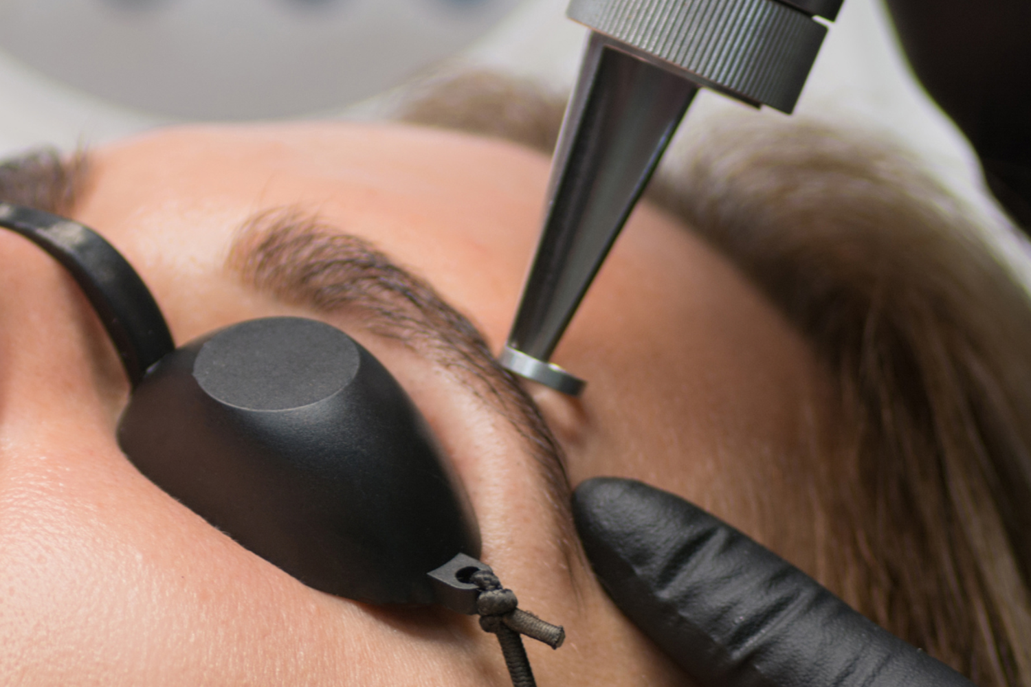 Verwijderen Microblading