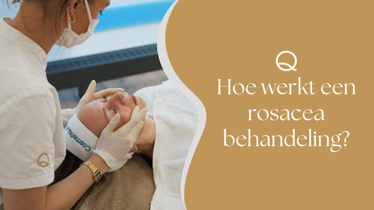 Hoe Werkt Een Rosacea Behandeling (1)